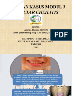 "Angular Cheilitis": Laporan Kasus Modul 3