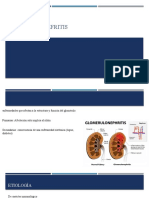 Glomerulonefritis