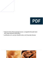 Aortic Stenosis