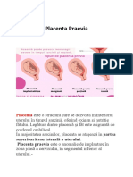 Placenta Praevia