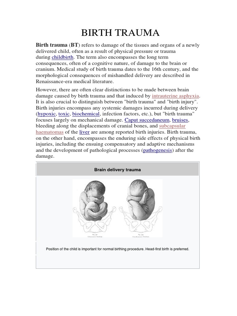 Birth Trauma | PDF