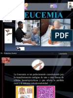 26 Leucemia Exposicion Dr. Averos.