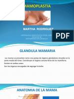 Mamoplastia de Reduccion