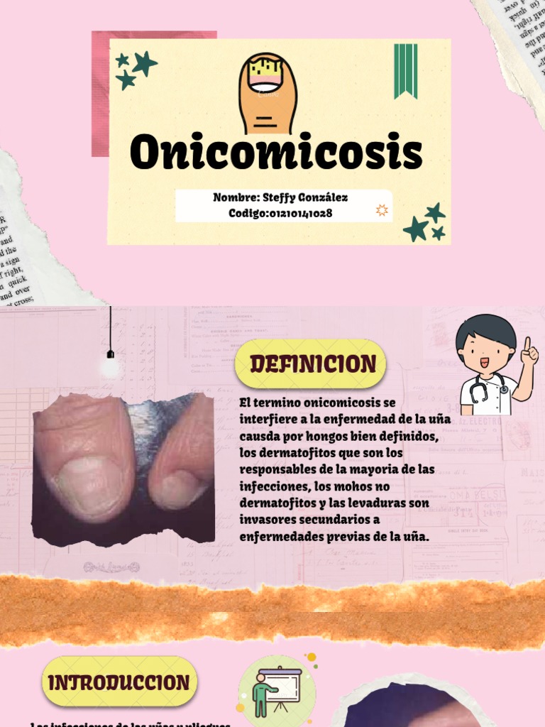 ONICOMICOSIS | PDF