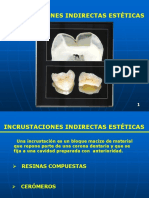 Incrustaciones Estéticas