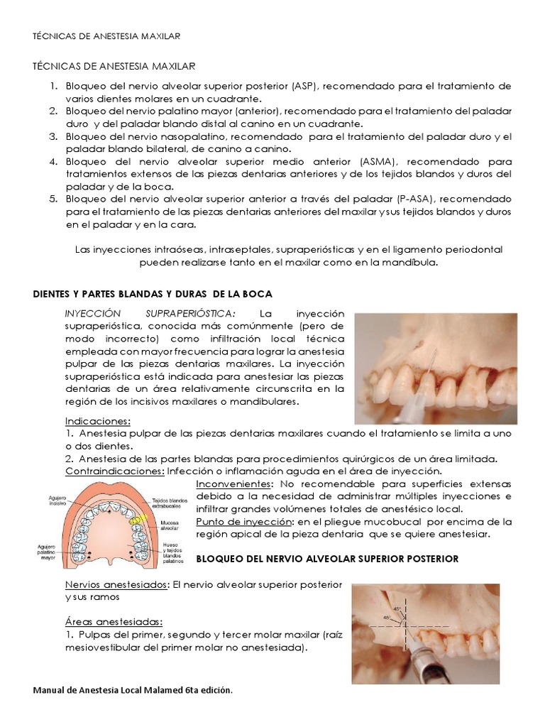 Técnicas de Anestesia Maxilar | PDF | Anatomía humana | Anatomia dental
