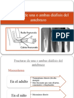 Copia de Fracturas de Una o Ambas Diáfisis Del Antebrazo