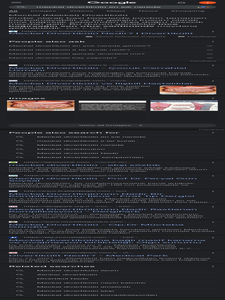 Meckel Divertikülü en Sık Nerede Google Search PDF