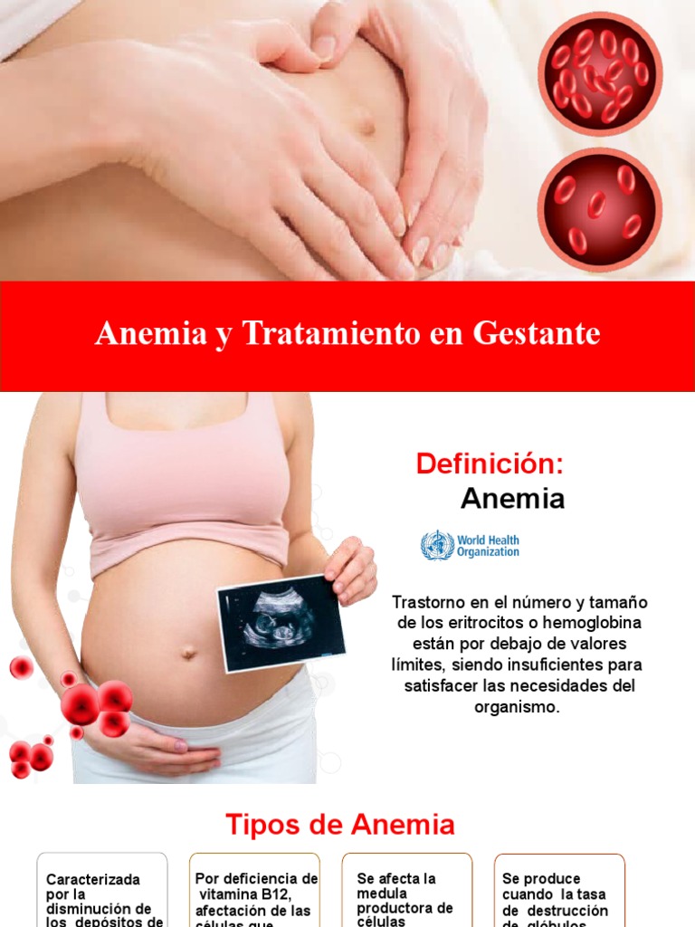 Anemia en El Embarazo Rmma | PDF | Anemia | El embarazo