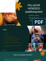 PALADAR ENDIDO (Palatosquisis)