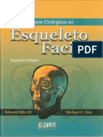 Acessos Cirúrgicos Ao Esqueleto Facial-225