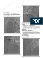 TCTAP C-110: Journaloftheamericancollegeofcardiology, Vol.67, No.16, Suppls, 2016