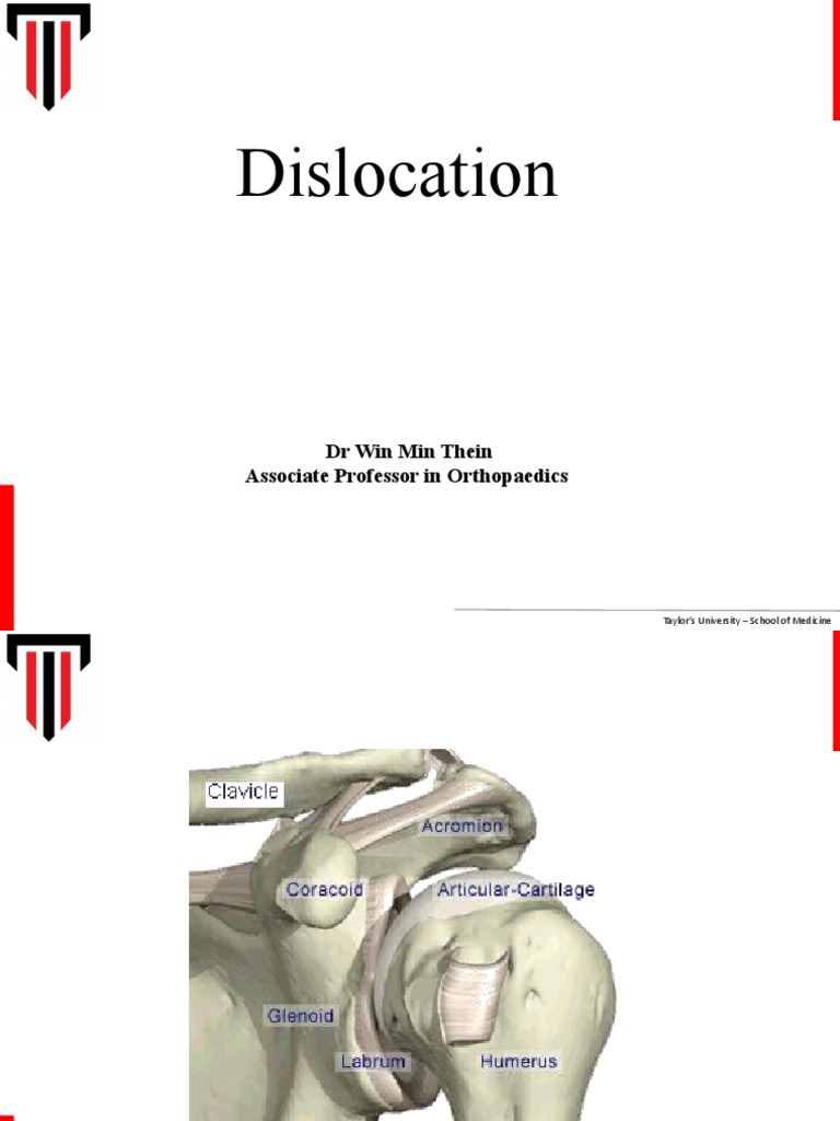 Dislocation Management in Orthopaedics | PDF | Hip | Shoulder