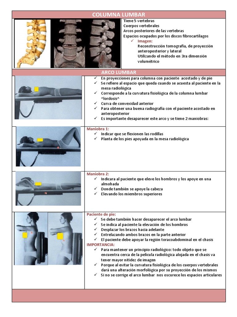 Columna Lumbar | PDF | Vértebra | La columna vertebral