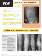 Signo de Jobert y neumoperitoneo | PDF
