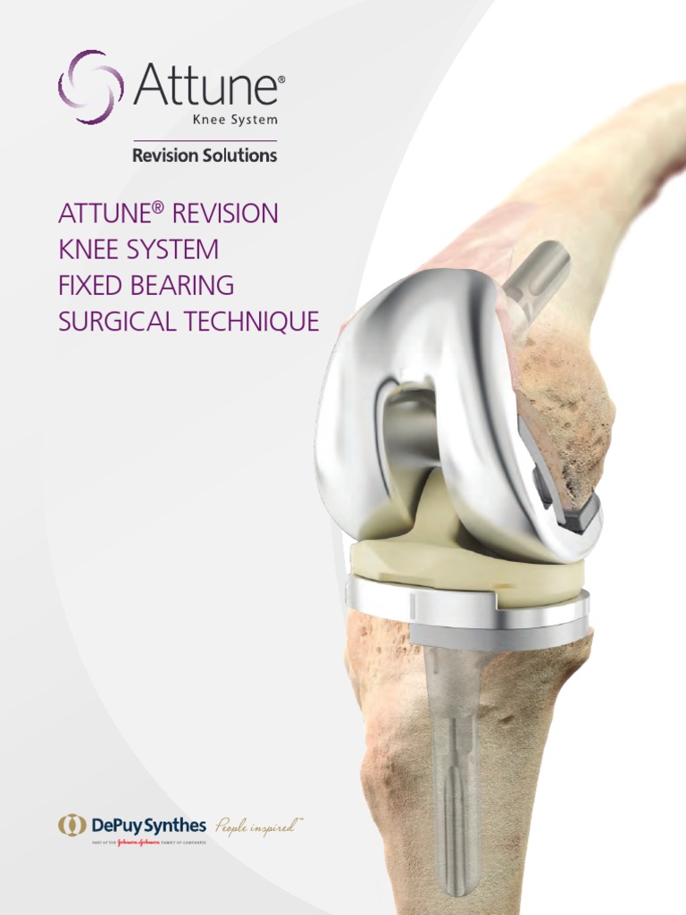 Attune FB Revision Surgical Technique PDF Knee Musculoskeletal System