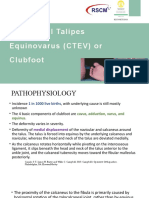 Clubfoot Pathophysiology and Ponseti Treatment