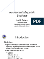 Adolescent Idiopathic Scoliosis. DR LG