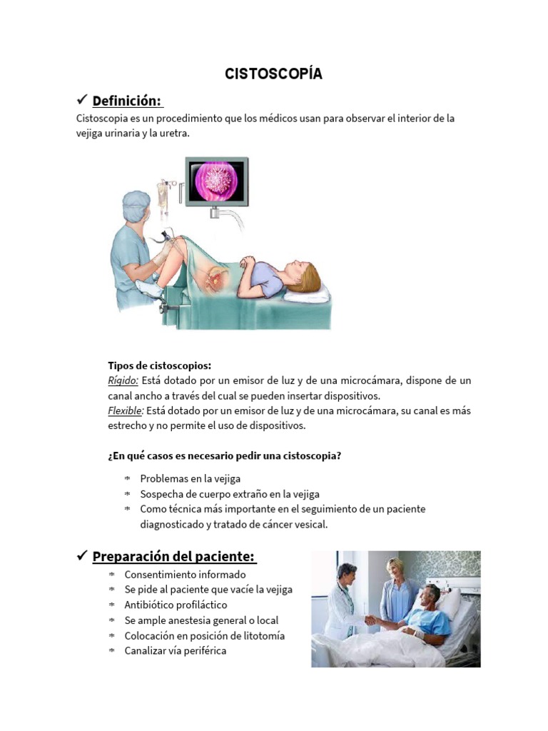 Procedimiento y Preparación de Cistoscopía | PDF | Vejiga urinaria ...
