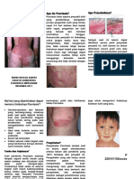 Leaflet Psoriasis