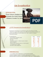 Desnutrición Kwashiorkor