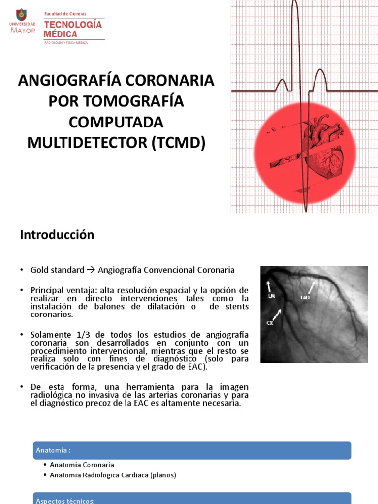 Angiografía Coronaria por TCMD | PDF | Electrocardiografia | Angiología