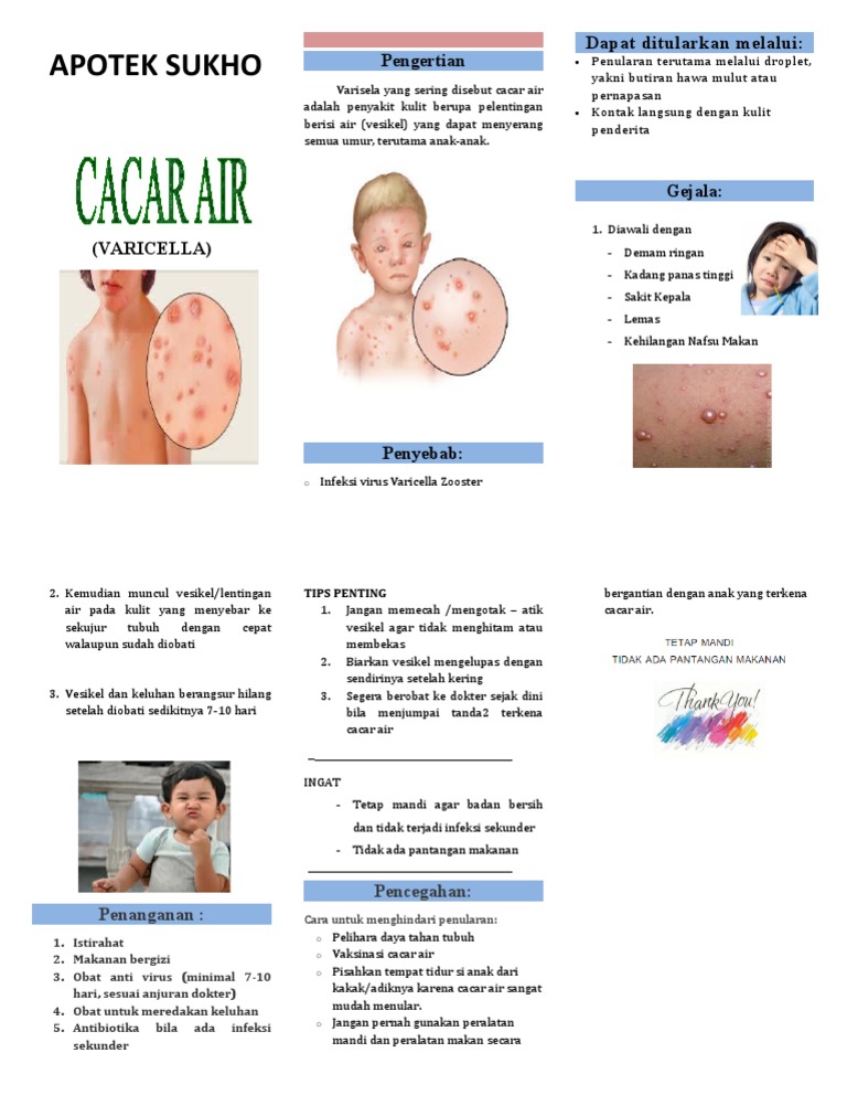 Panduan Penanganan Cacar Air Anak | PDF