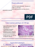 II.3. Biopsia Pulmonara