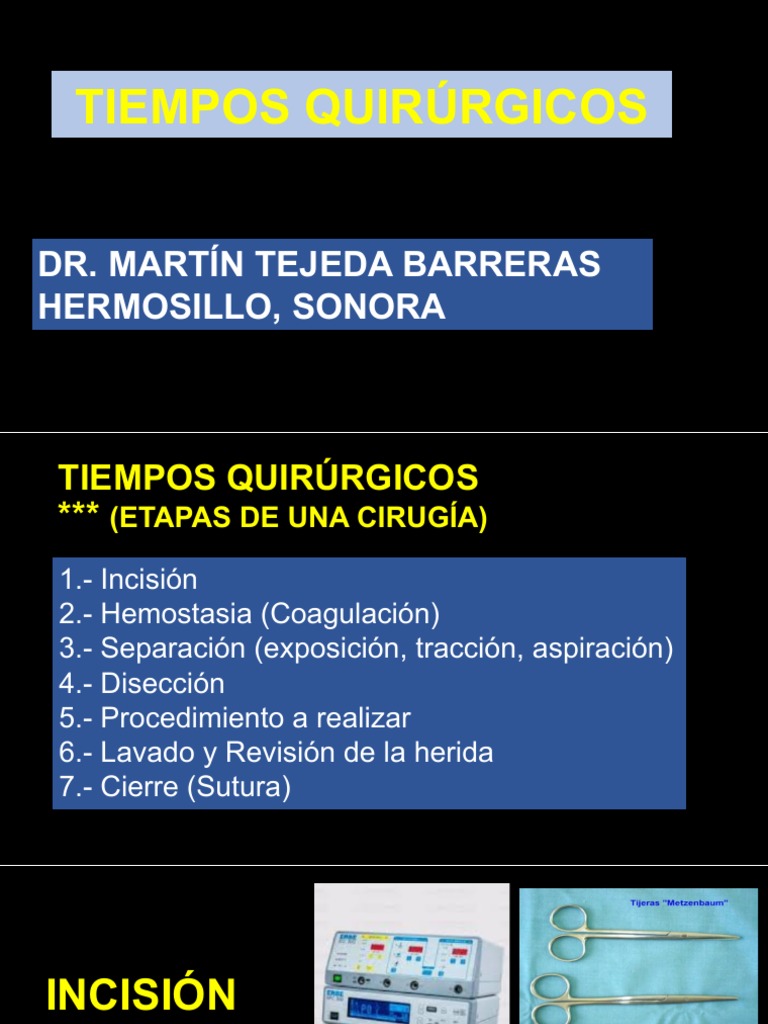Tiempos quirúrgicos: Una guía detallada de las etapas clave de una