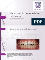 Corrección de Línea Media en Ortodoncia