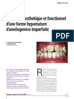 Amélogenèse Imparfaite