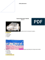 Soal Latihan Patologi Sistem Saraf Perifer