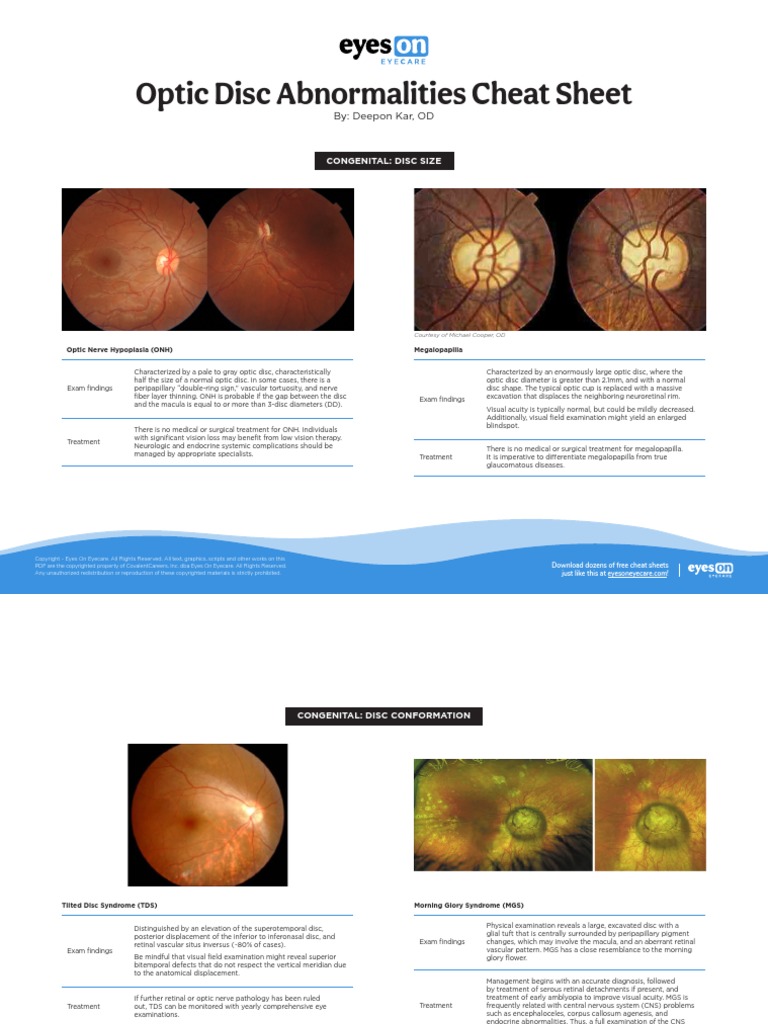 Optic Disc Abnormalities Cheat Sheet PDF Ophthalmology Medicine