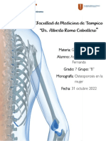 Osteoporosis en La Mujer