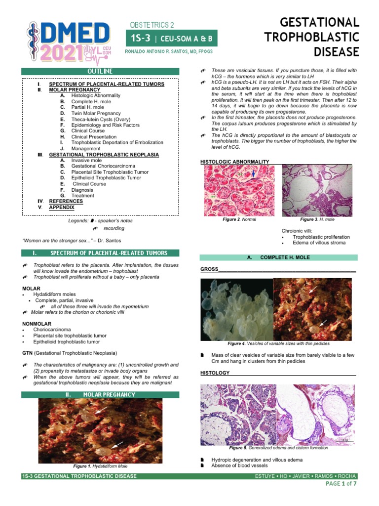 Gestational Trophoblastic Disease | PDF | Human Chorionic Gonadotropin ...