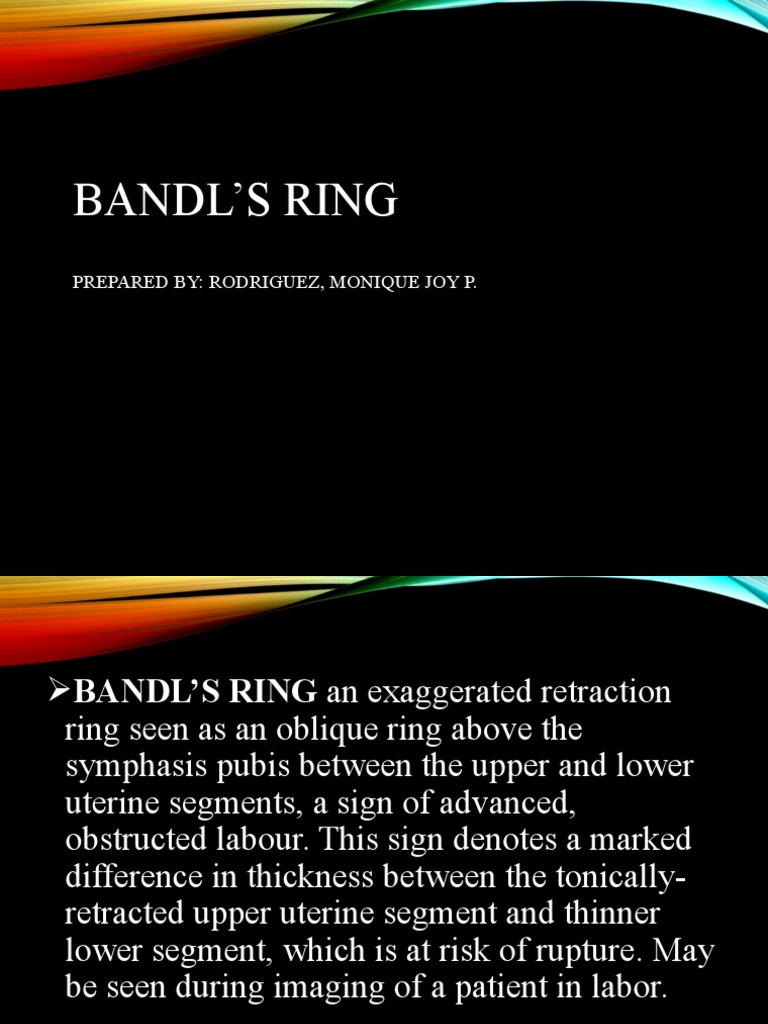 Bandls Ring Monq PDF