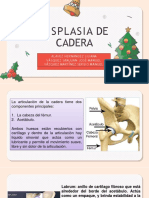 Displasia de Cadera.