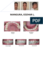 Mangura, Edzhar L.: Maxillary Mandibular