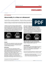 Abnormality in a fetus on ultrasound