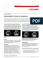Abnormality in A Fetus On Ultrasound