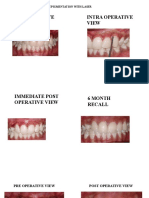 Case Report Depigmentation