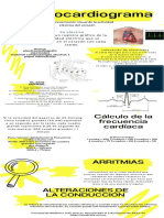 Electrocardiograma