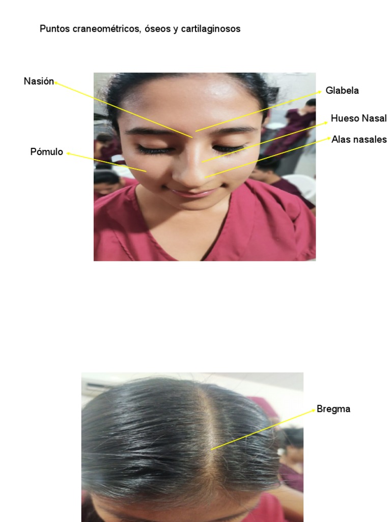 Puntos Craneométricos, Óseos y Cartilaginosos PDF