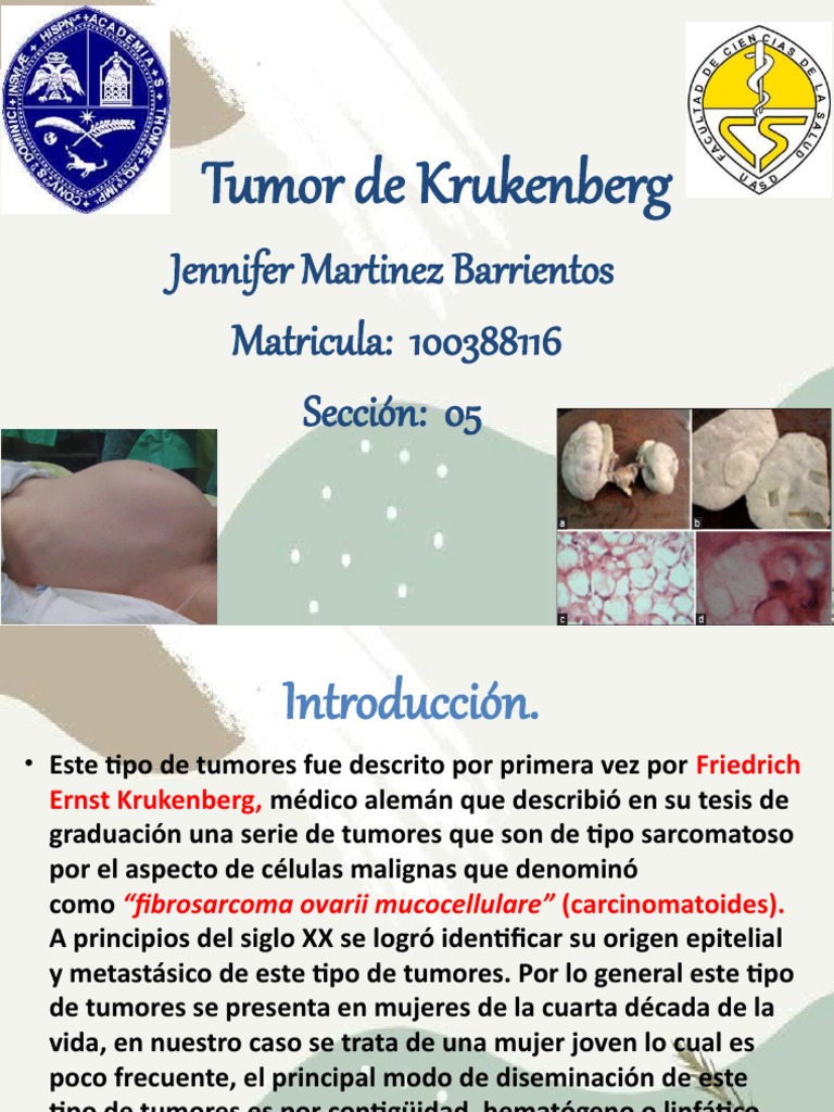Tumor de Krukenberg Descargar gratis PDF Cáncer colonrectal