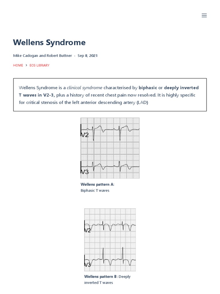LITFL - Wellens Syndrome | Download Free PDF | Myocardial Infarction ...