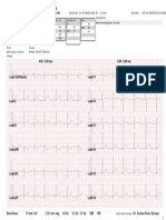 Fundación Cardio Infantil - Informe de Ecg: Lina Fernanda Sanchez Castaño