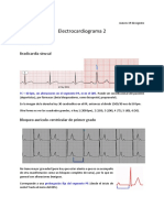Electrocardiograma 2