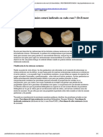 ¿Qué sistema cerámico estará indicado en cada caso