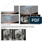 Clase de Pancratitis 7 de Nov PDF