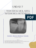 Terceros Molares Inferiores Retenidos